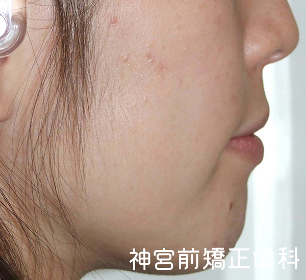 正しいかみ合わせとは 矯正治療の治療ゴールとは アイ ステーションの社団法人日本先進矯正歯科学会